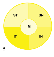 <p><strong>Nasal fibers</strong> radiate directly to the <strong>nasal </strong>side of the disc. </p><p><strong>Papillomacular</strong> bundle course to the <strong>temporal </strong>side of the disc. </p><p>Fibers from the<strong> superior arcuate</strong> arch around the papillomacular bundle to enter the<strong> superior </strong>pole of the disc. The same with the <strong>inferior </strong>to enter the <strong>inferior pole. </strong></p><p><strong>Macular fibers</strong> take up <strong>one third of the disc</strong>, despite the macular area being <strong>only one twentieth of the total retinal area.</strong></p><p>The <strong>temporal fibers</strong> take up <strong>another third</strong>, and lastly the<strong> nasal fibers </strong>take up the<strong> last third. </strong></p><p><strong>Boundaries </strong>between each set of fibers are <strong>not always clear-cut. </strong></p><p>Fibers from the <strong>peripheral retinal are more superficial </strong>than those coming from central locations</p><p><strong>Macular fibers move to the center </strong>of the nerve. </p><p>The <strong>rest all line up</strong> in their respective logical location (e.g., superior temporal in the superior temporal portion of the nerve).</p>