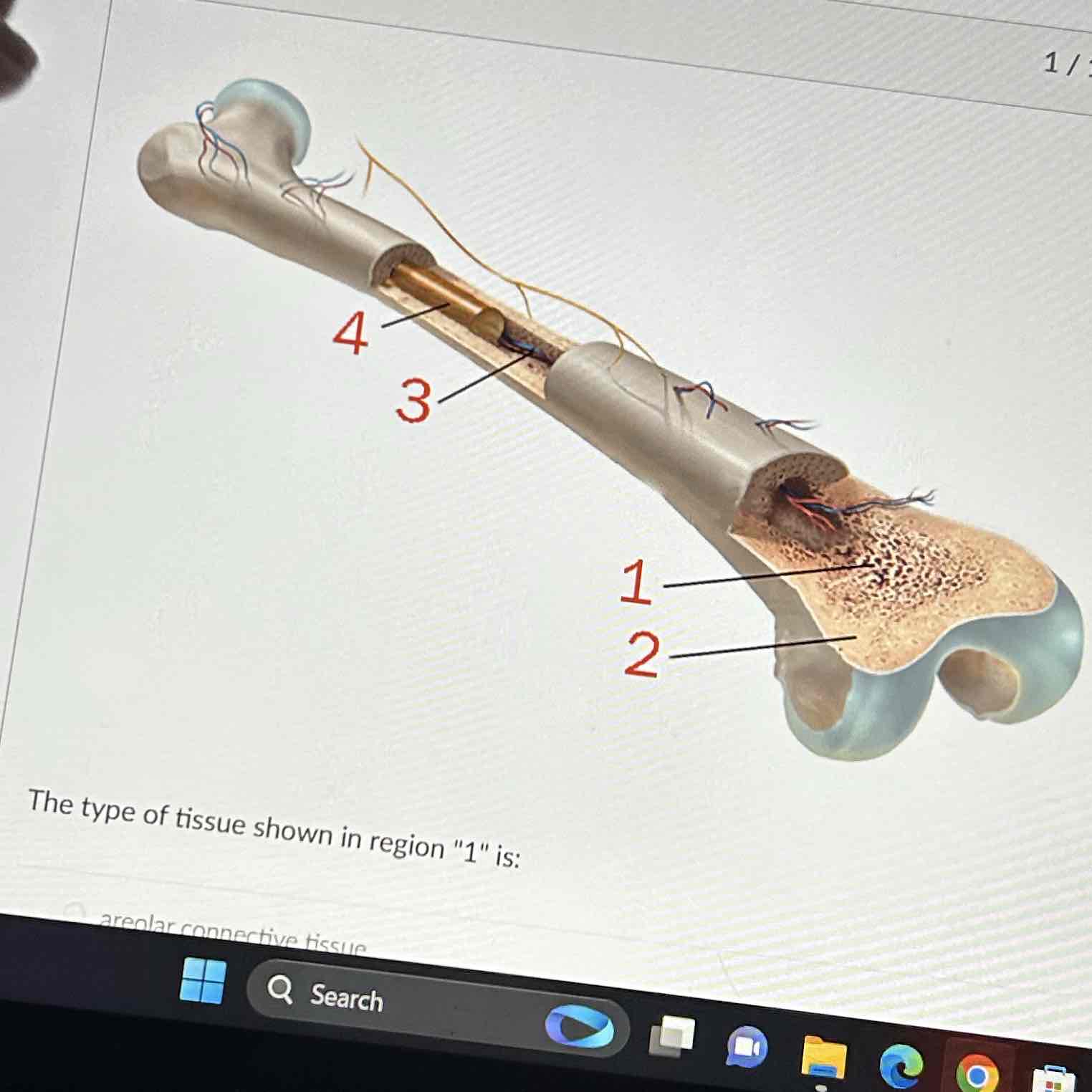 <p>The type of tissue shown in region “1” is </p>