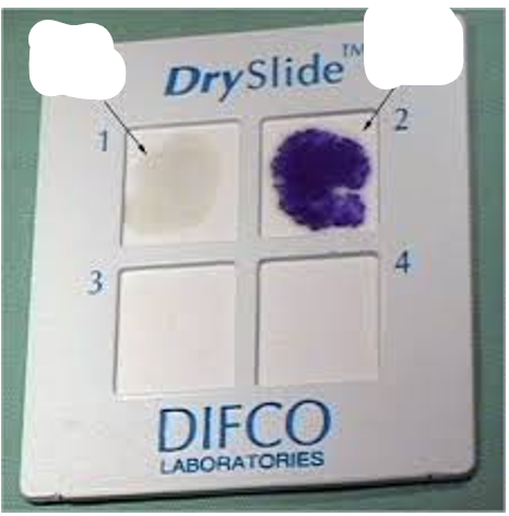 <p>which is oxidase positive and oxidase negative</p>