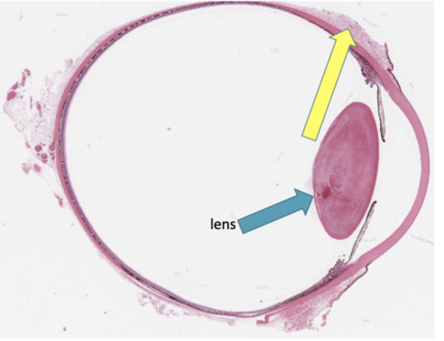 <p>Identify the general structure or layer (YELLOW ARROW)</p>
