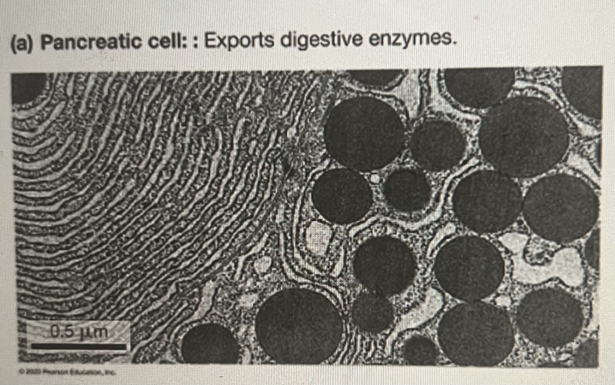 <p>Given that you can visualize an increased amount of Golgi apparatus in addition to lots of rough ER in the secretory cell from the pancreas shown in the figure below, what would you predict its function is?</p>