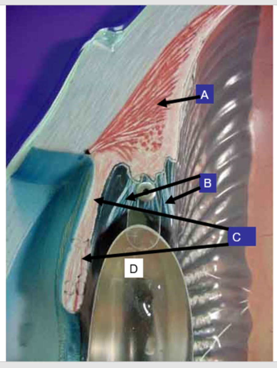 <p>What structure is the letter D?</p>