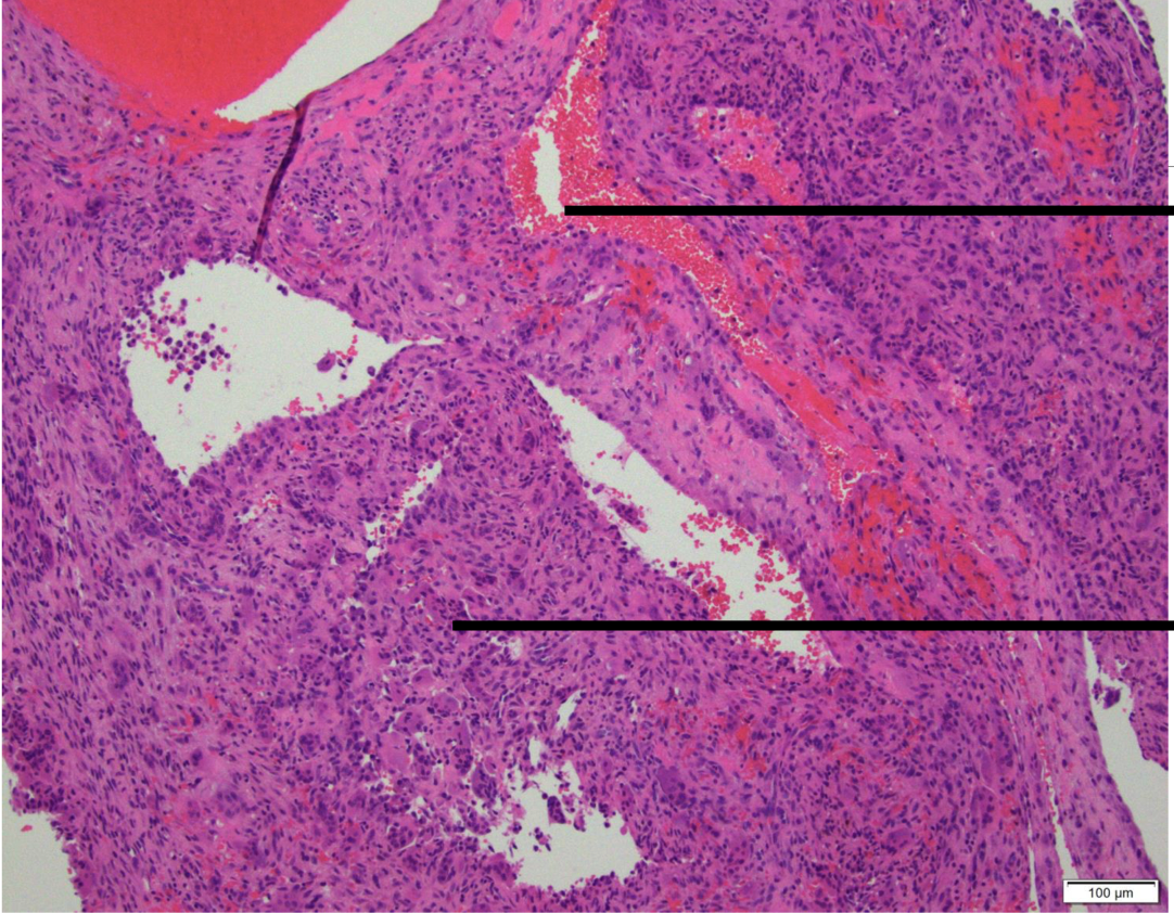 <p>Label from top to bottom and diagnose</p>