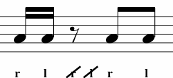 <p>What Variation is This? </p>