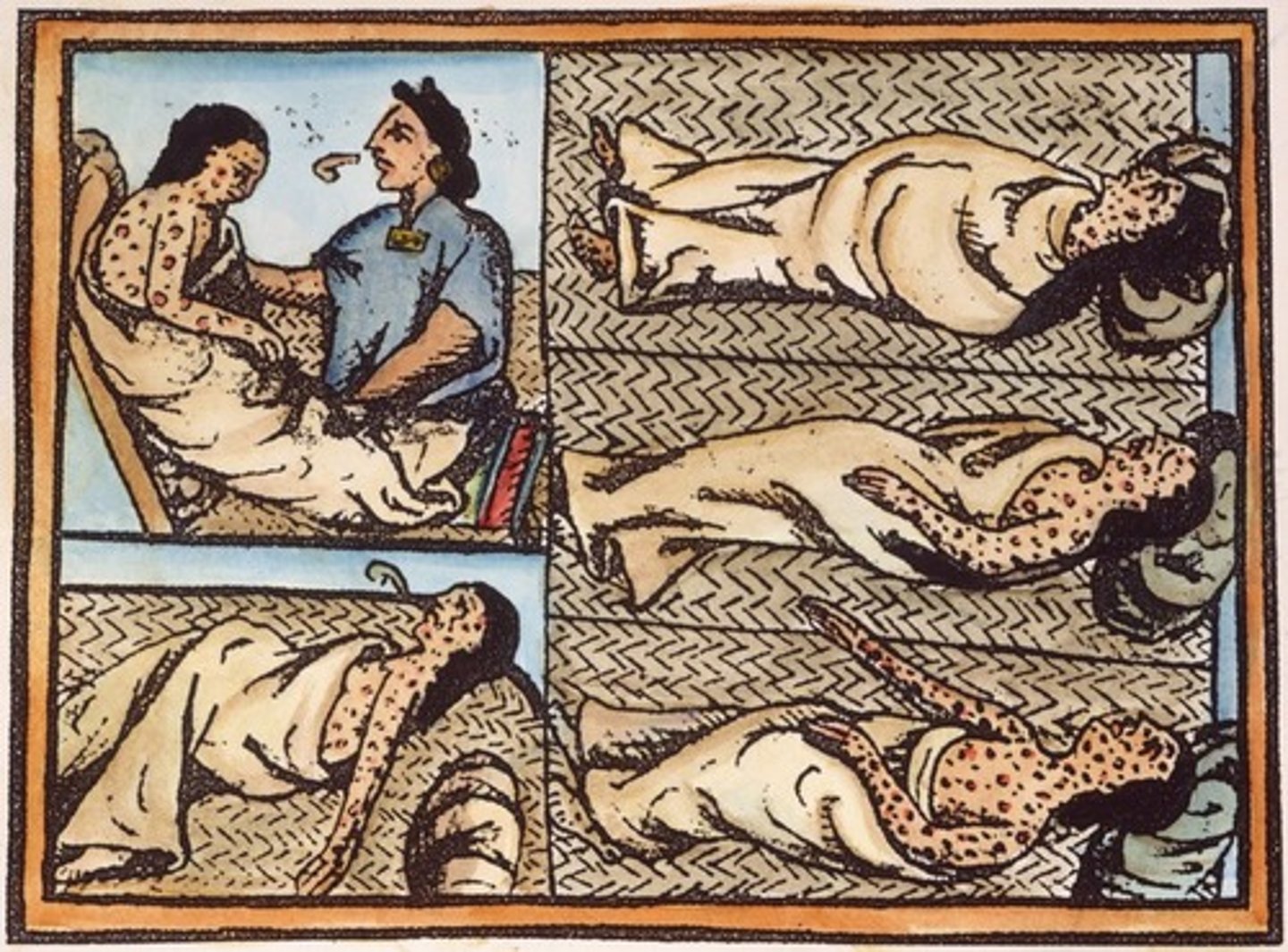 <p>A highly contagious viral disease characterized by fever, weakness, and skin eruption</p>