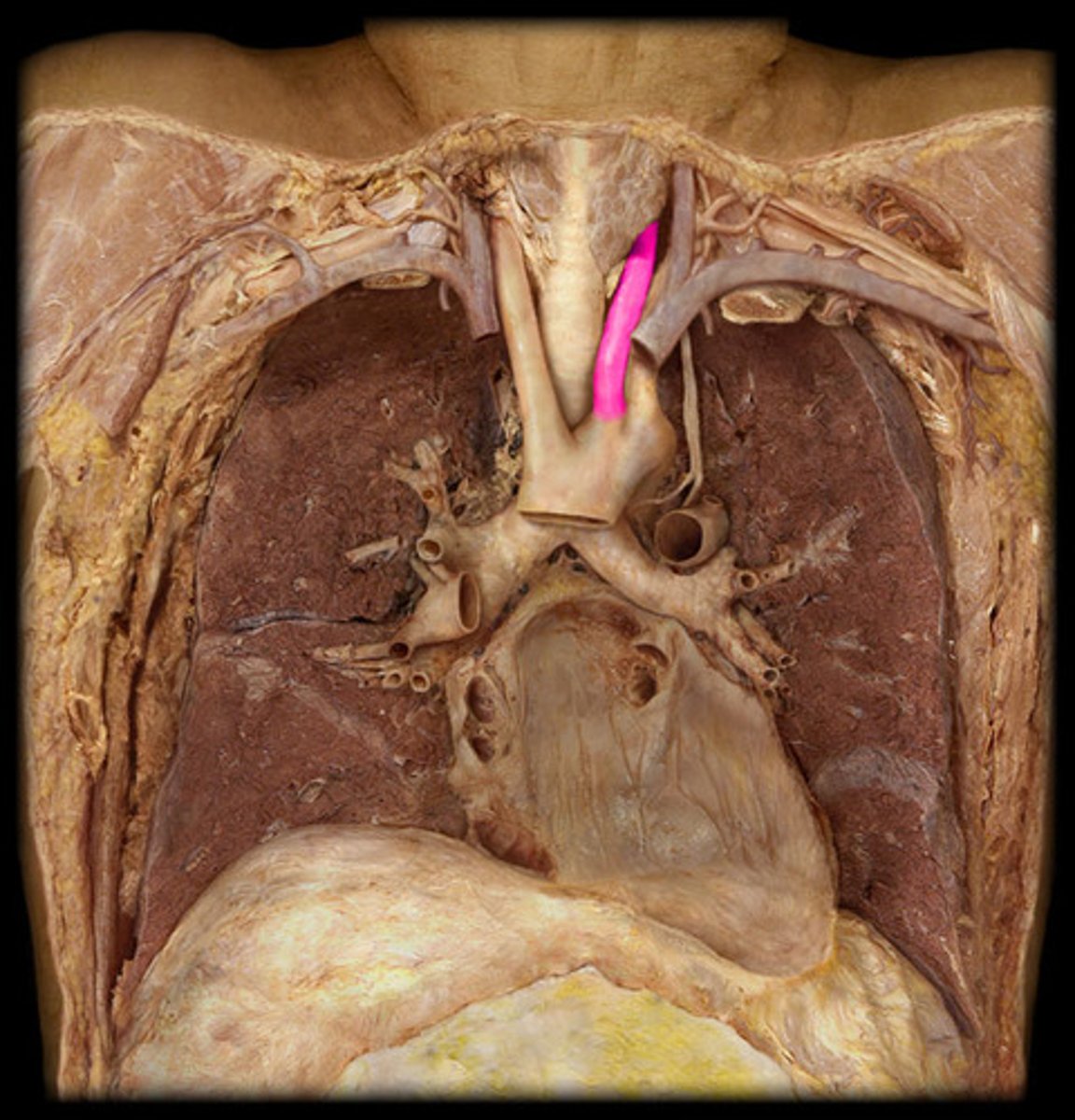 <p>second branch off the aortic arch</p>