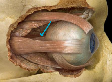 <p>what muscle?</p>
