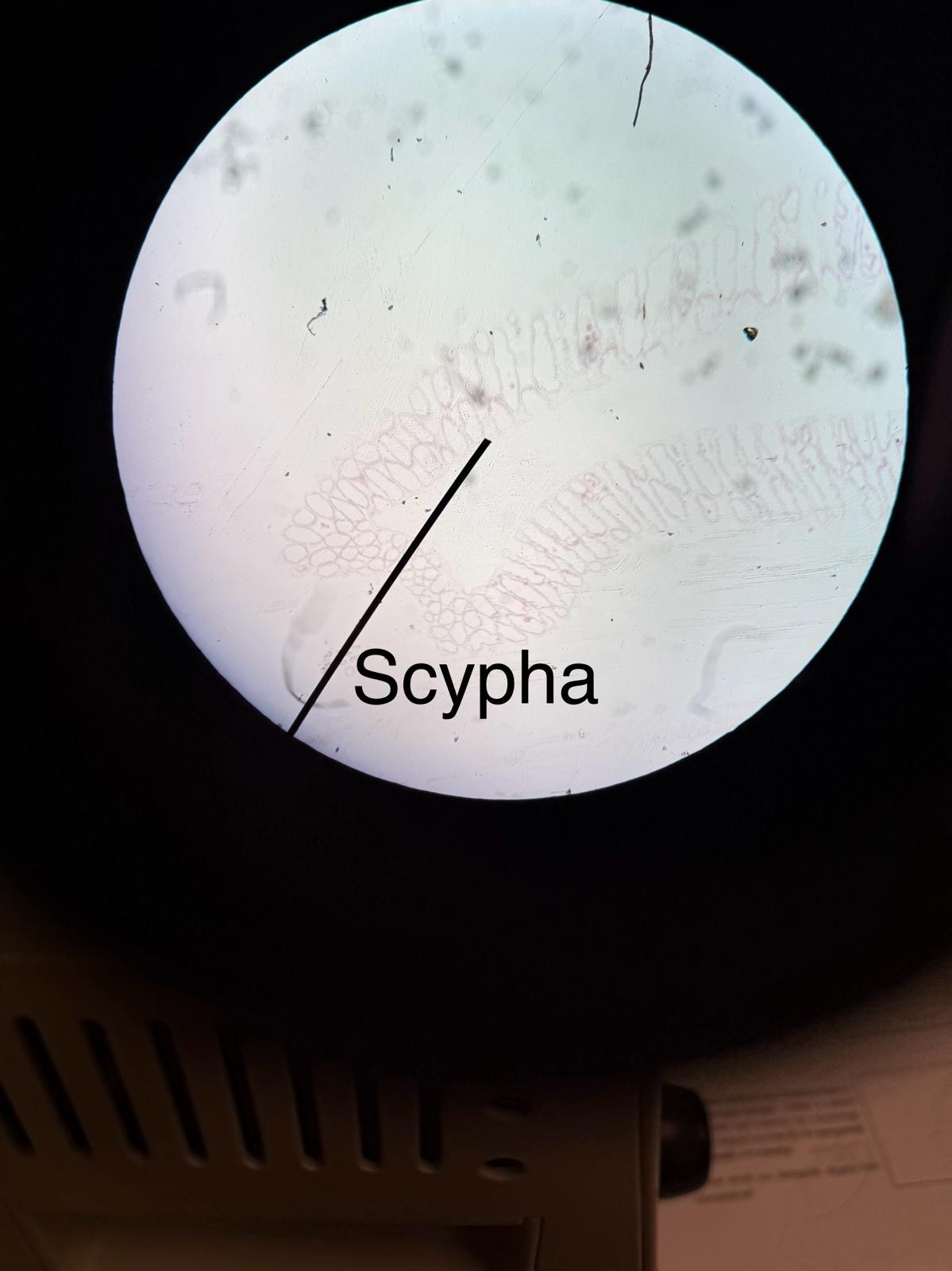 <ul><li><p><strong>Spongocoel</strong> – central cavity.</p></li><li><p><strong>Osculum</strong> – opening at the top.</p></li><li><p><strong>Spicules</strong> – support structures (look like glass needles).</p></li><li><p><span>Animilia &gt; Porifera (sponges) &nbsp;&gt; Calcarea &gt; Scypha</span></p></li></ul><p></p>