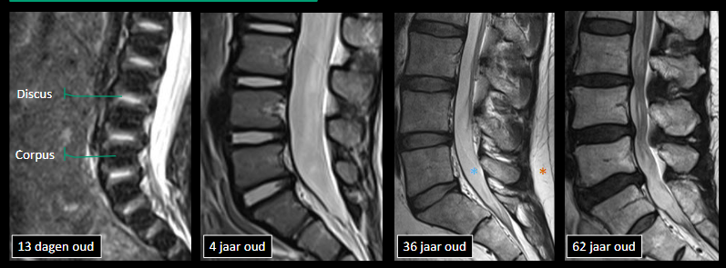 <p>kenmerken T2 venster</p>
