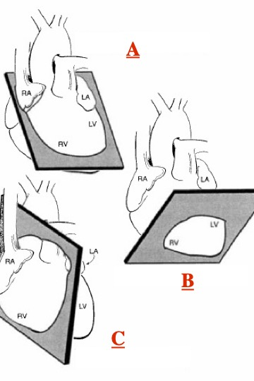 <p>What plane is C?</p>