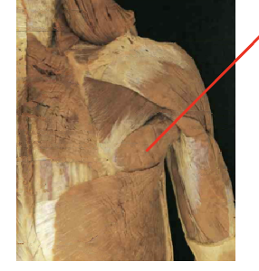 <p>What muscle is this&nbsp;What is its origin. Where does it inserts. </p>