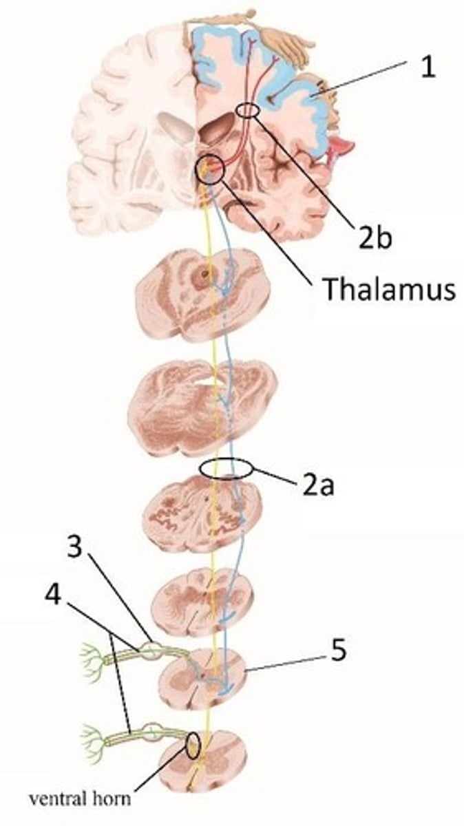 <p>Pathway that carries pain, temperature, crude touch, and pressure information to the brain.</p>