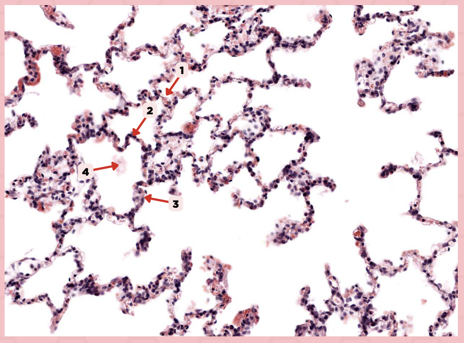 <p>What kind of epithelium are these alveolar cells?</p>
