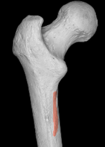 <p>offshoot on proximal end from medial supracondylar line of femur</p>