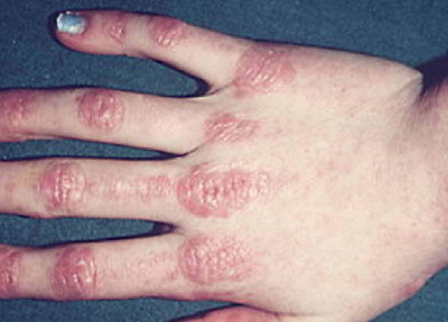 <p>What is the diagnosis?</p>