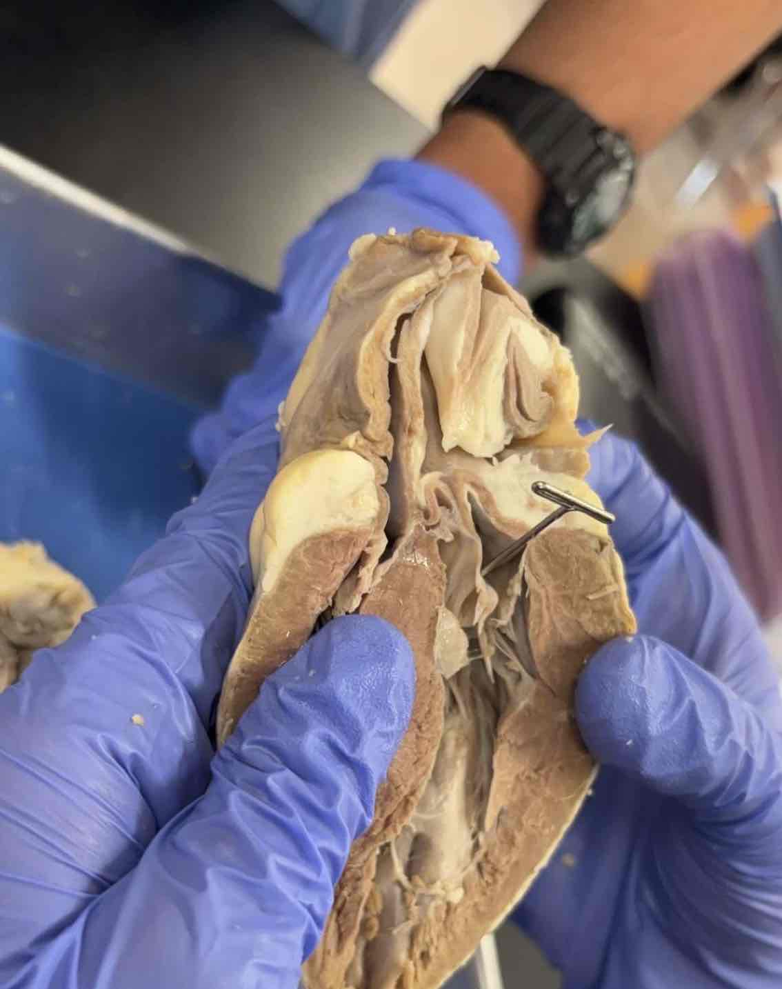 <p>What cavity of the heart is this?</p>