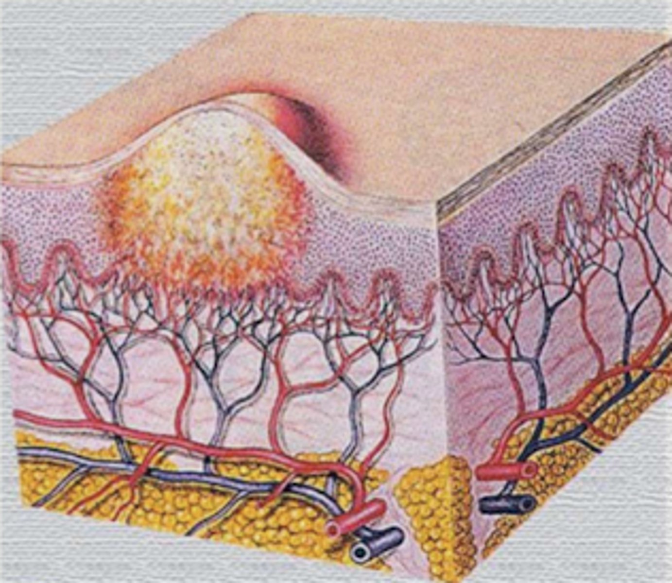 <p>¿lesión?</p><p>¿primaria o secundaria?</p>