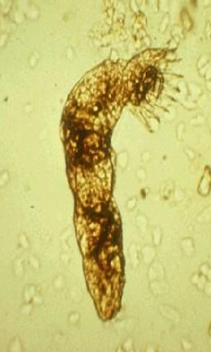 <p>Family?</p><ul><li><p># Paired Anchors</p></li><li><p># Marginal Hooklets</p></li></ul><p></p>