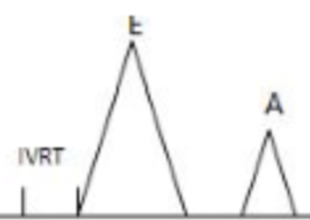 <p><strong>A-wave</strong> of MV inflow representing atrial systole</p>