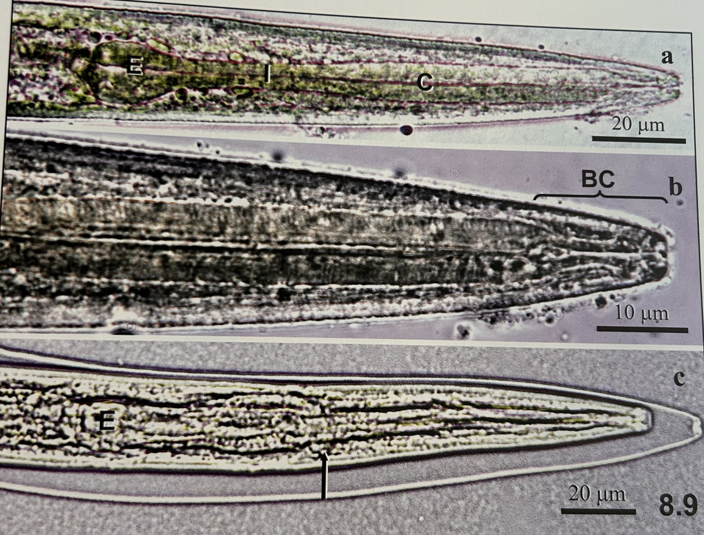 <p>characteristics of Rhabditiform vs. filariform larvae?</p>
