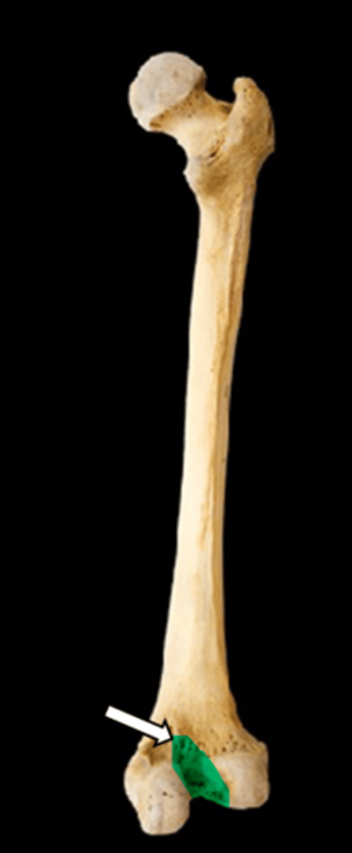 <p>name the part</p>