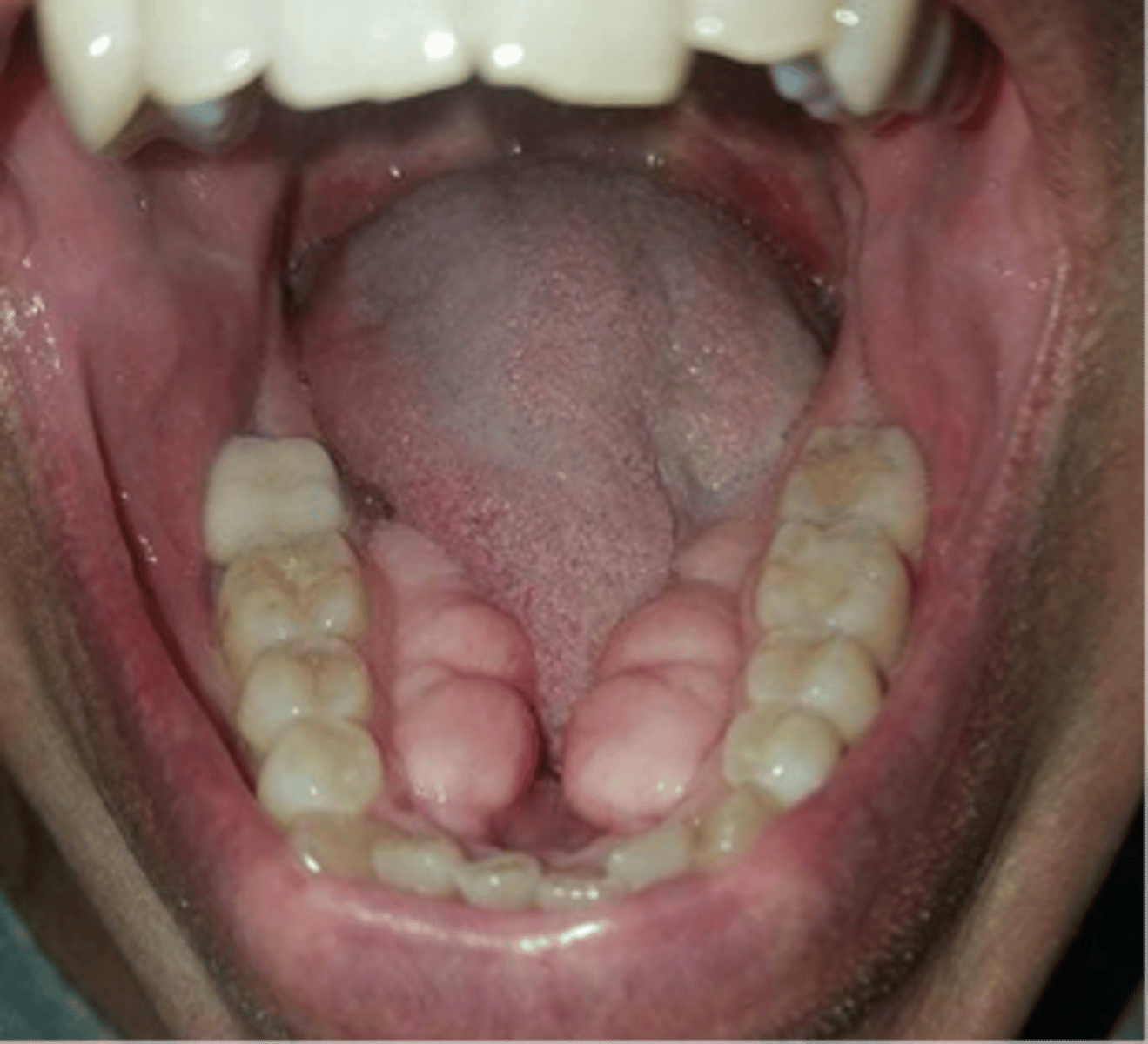 <p>What is pointed out here?</p>