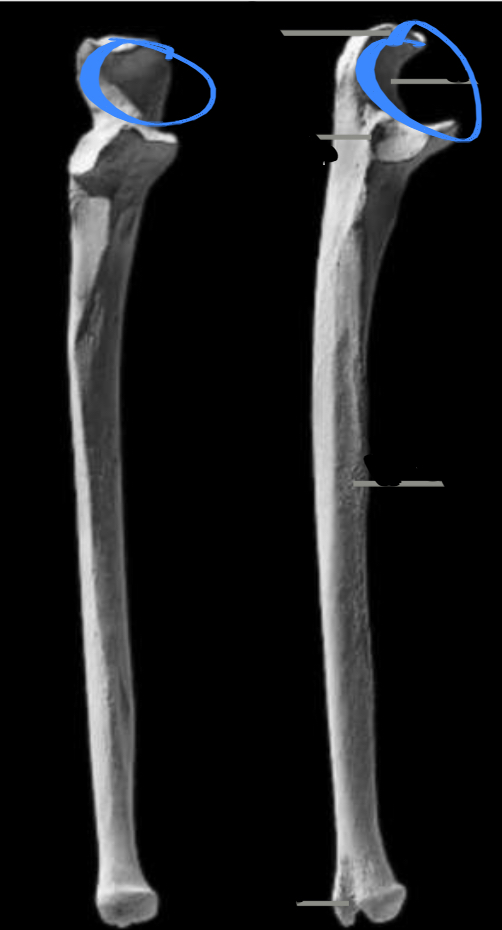 <p>Depression for humerus to articulate with, enabling flexion, located on the ulna</p>