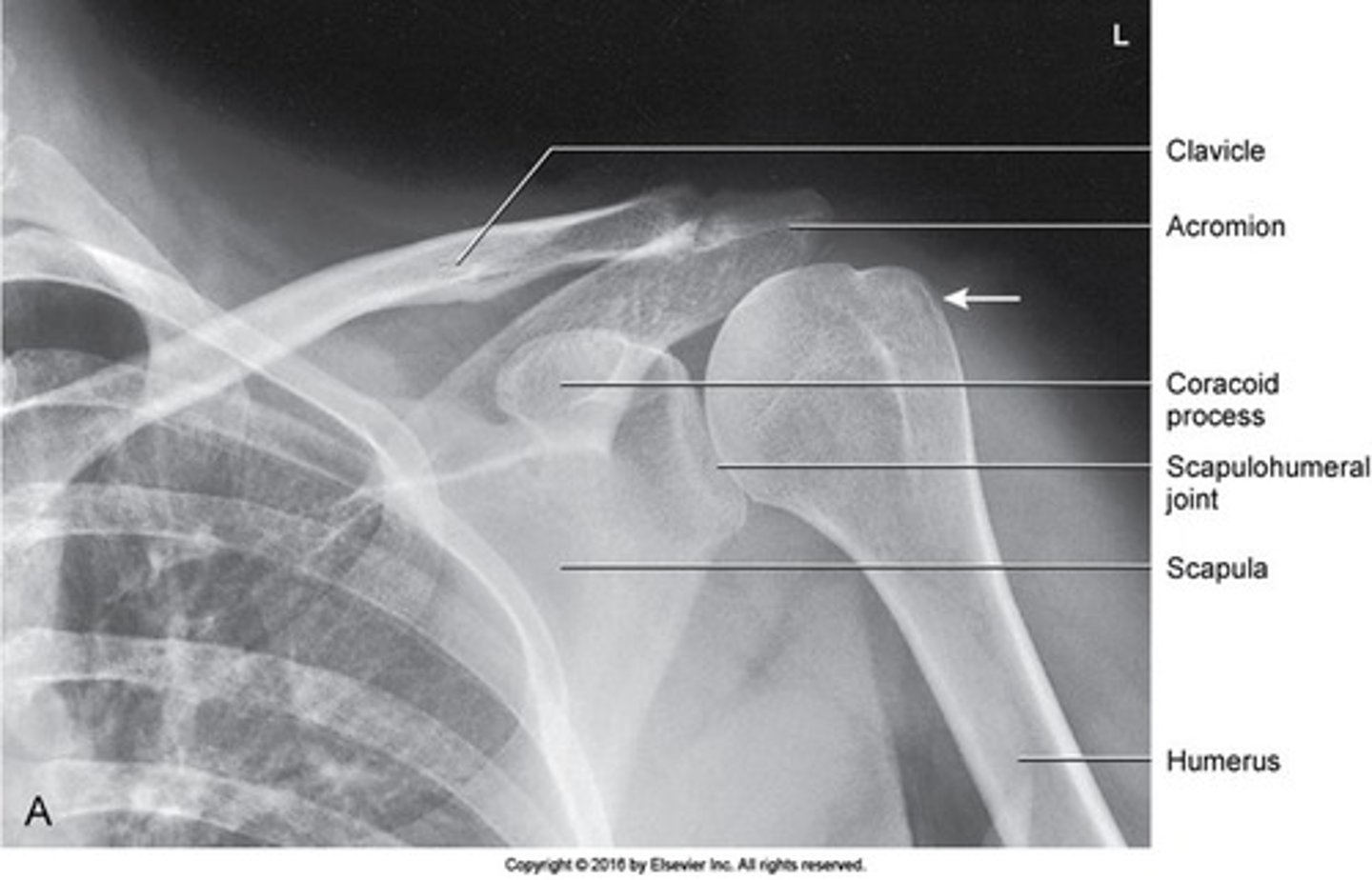 <p>- collimation includes superior scapula, lateral half of clavicle, and proximal humerus</p><p>- humeral head and greater tubercle</p><p>- lesser tubercule</p>