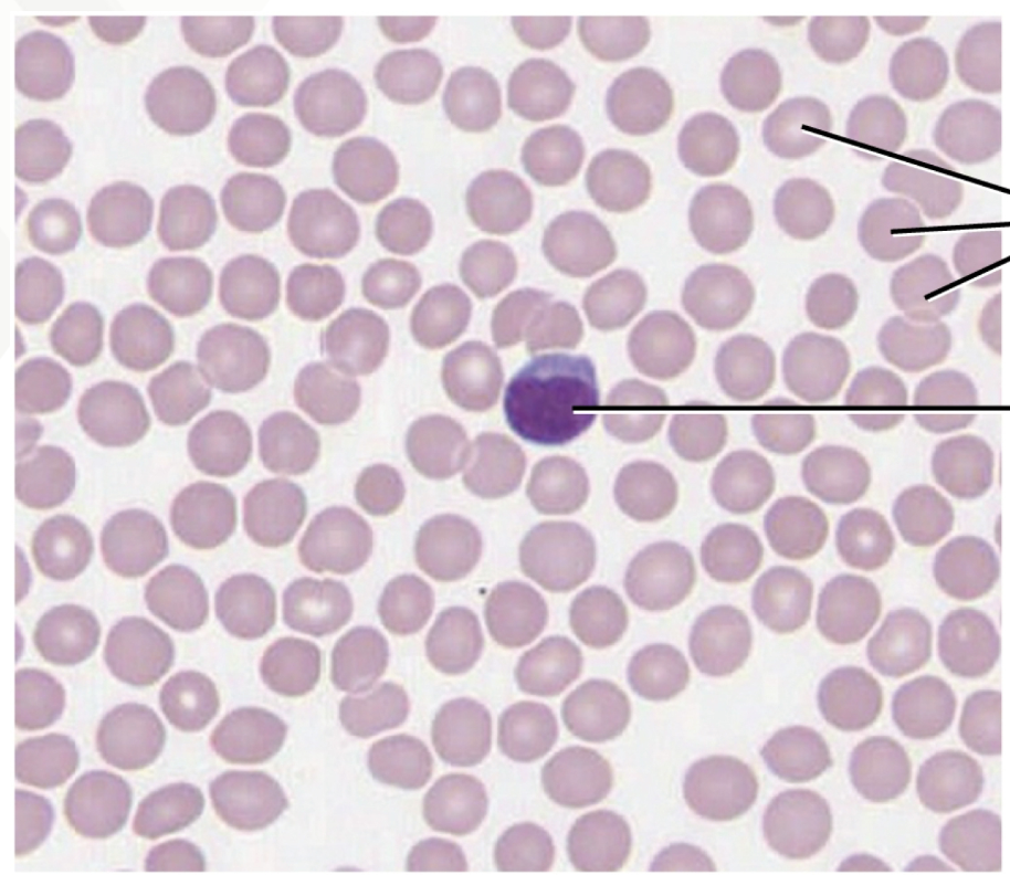 <p>Blood Connective Tissue</p><p>red blood cells - erythrocytes (pink)</p><p>white blood cells - leukocytes (purple)</p><p>platelets - thrombocytes </p><p>plasma - extracellular matrix </p>