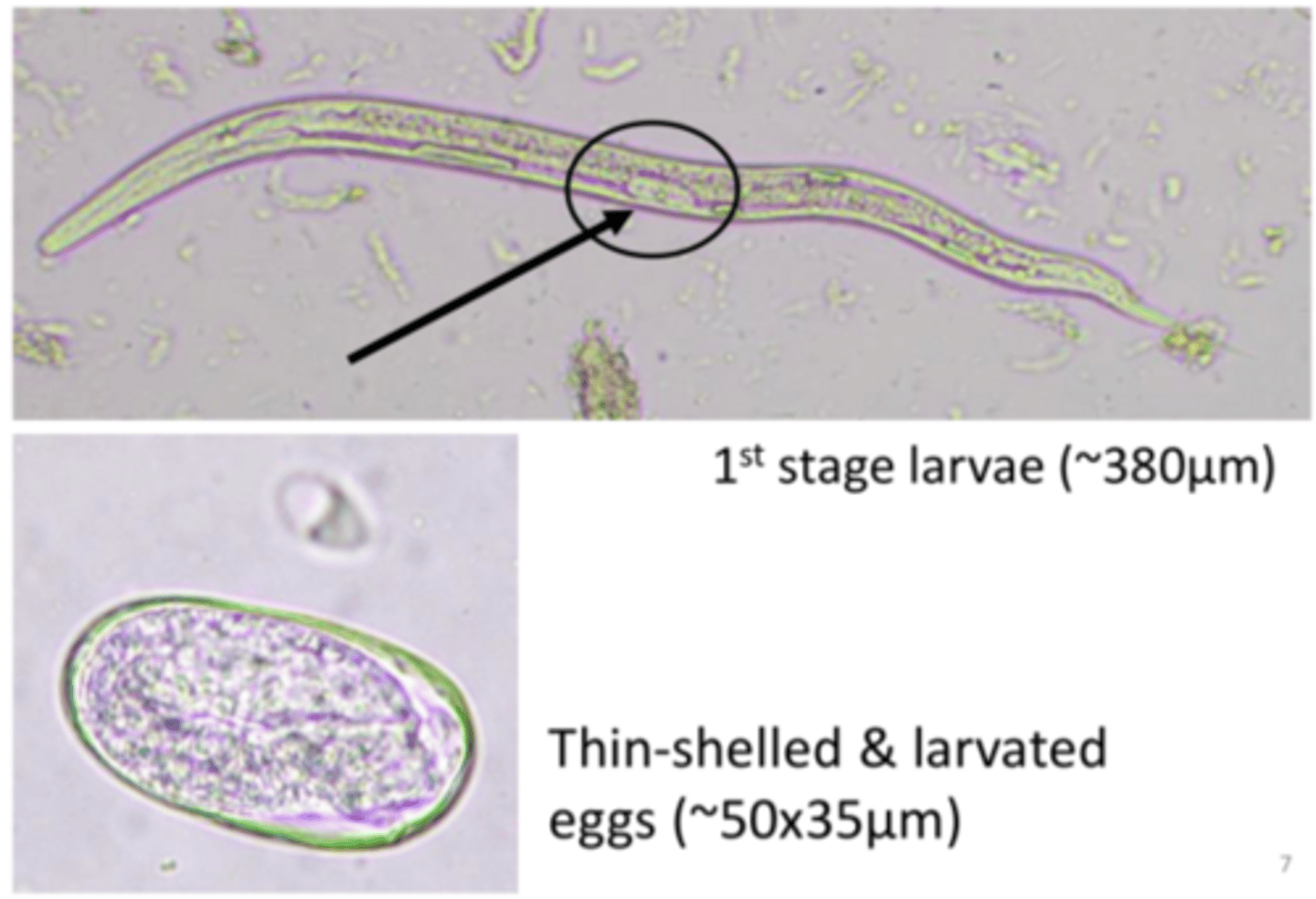 <p>Strongyloides stercoralis</p><p>-only females are parasitic, ~2.2mm in length</p>