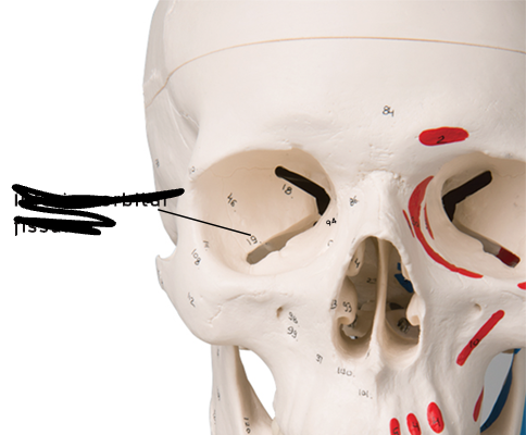 <p>bony marking?</p>