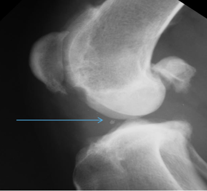 <p>What is the arrow pointing to?</p>