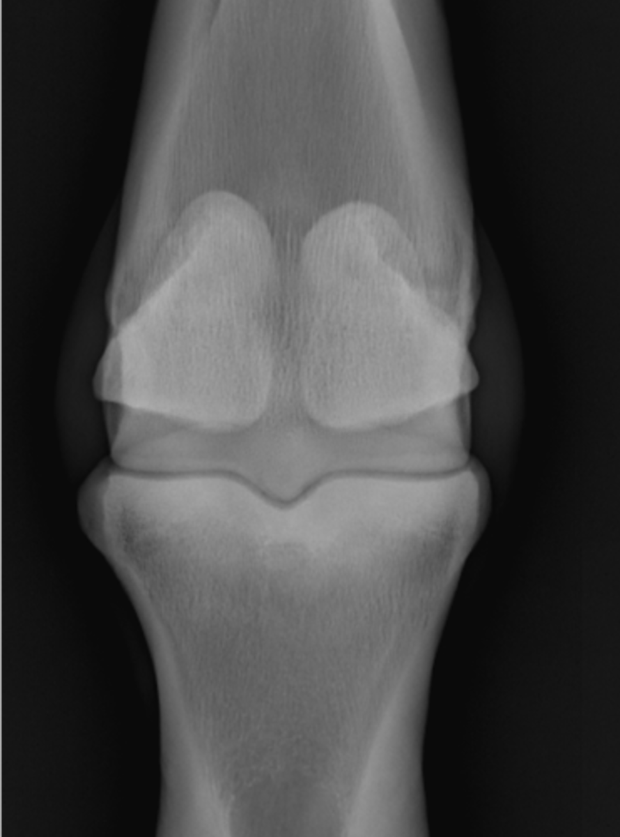 <p>ID joint and view</p>