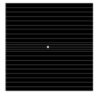 <p>What disease can this amsler chart detect</p>
