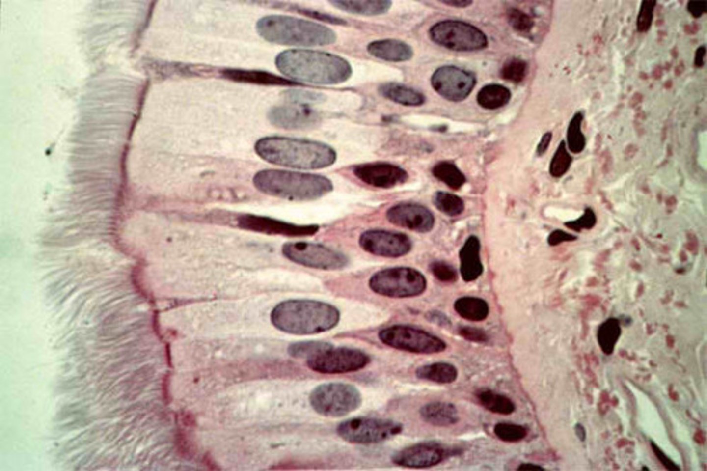 <p>1 layer of tall narrow cells with unorganized nuclei, hairs line the outer edge</p>