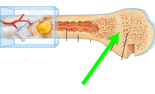 epiphyseal line
