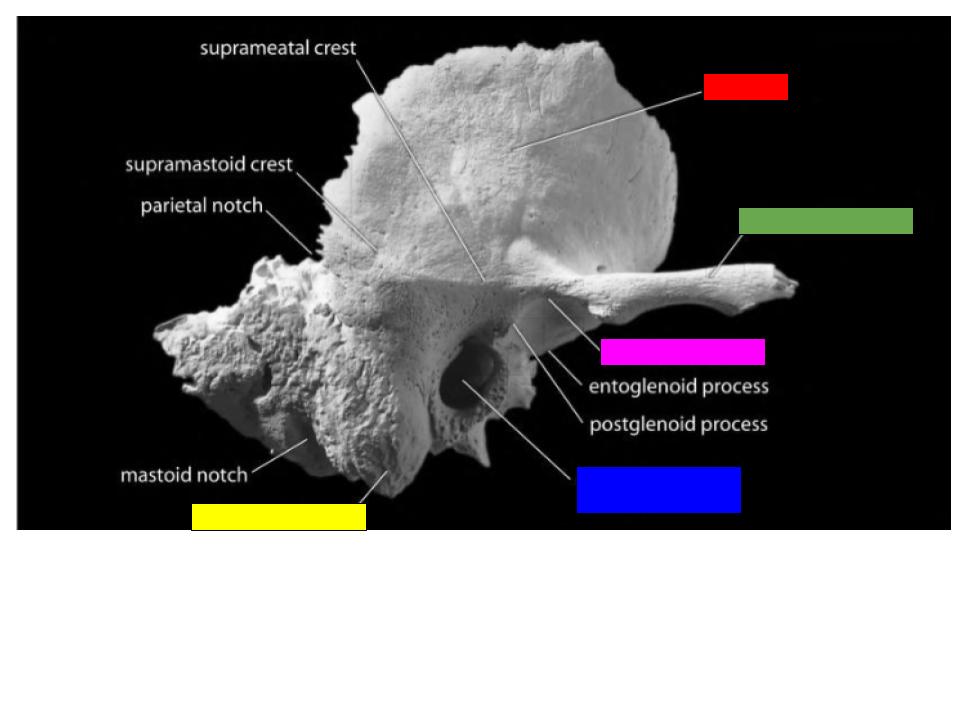 <p>What is the structure labeled in red?</p>