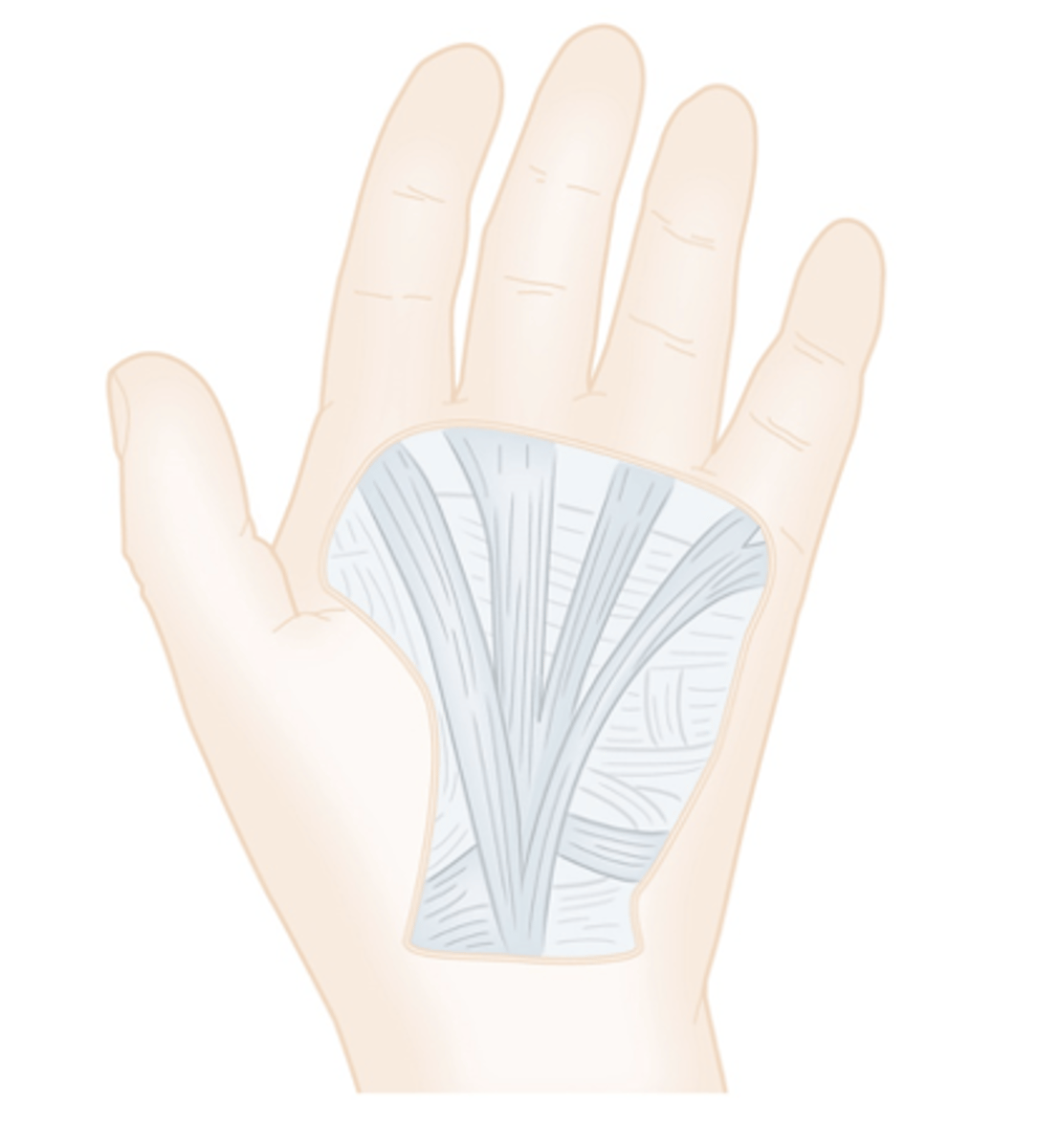 <p>- superficial, thick, triangular fascia located on palmar surface of wrist</p><p>- covers tendons of extrinsic muscle</p><p>- provides protection to structures of wrist and hand</p><p>- distal attachment of palmaris longus</p>