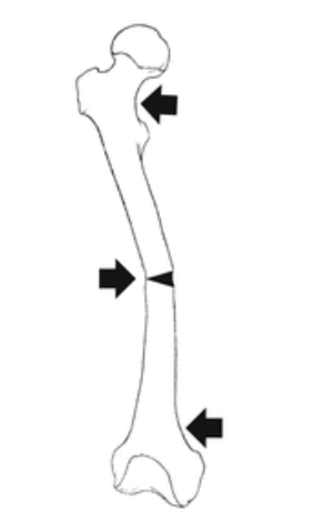 <p>What force is acting on the bone?</p>