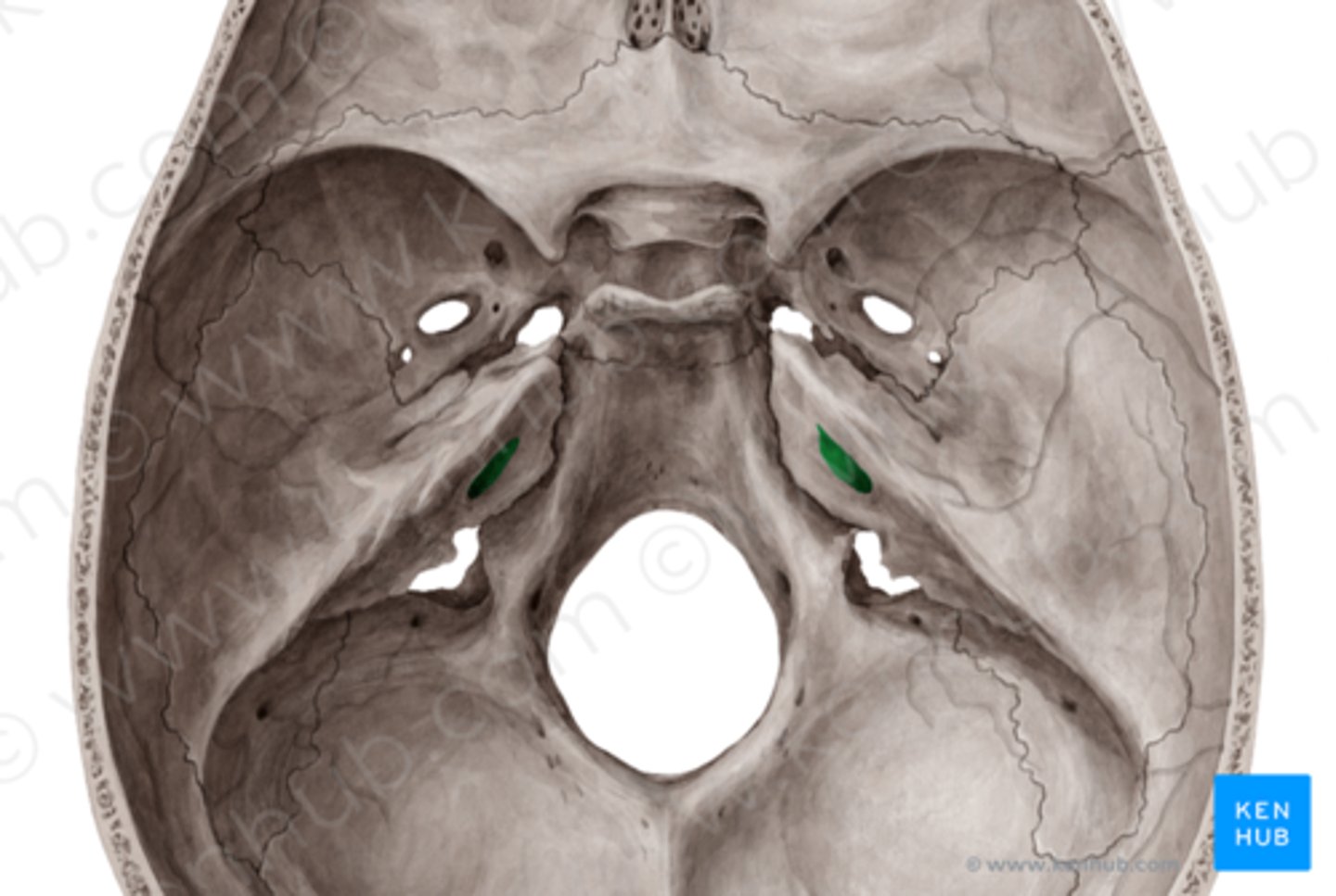 <p>Porus et meatus acusticus internus</p>