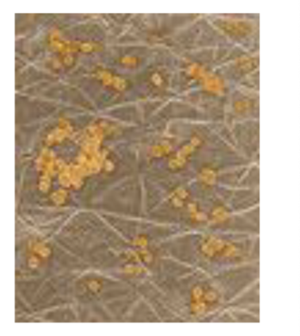 <p>Important human pathogen causing minor and serious diseases; can survive on dry surfaces and is heat-resistant. Gram positive and in grape clusters. Facultative anaerobic</p>