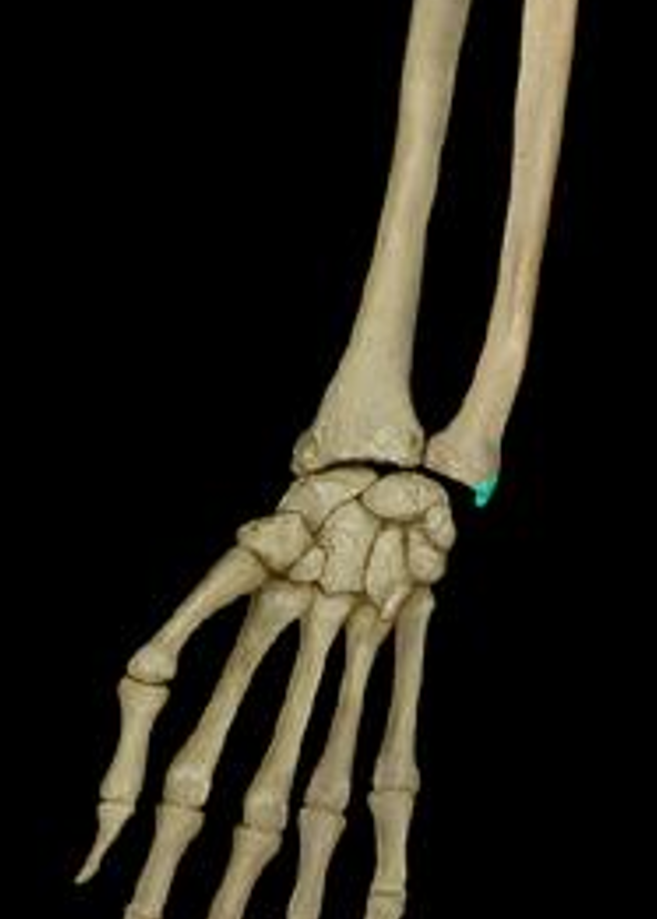 <p>a pointy projection at the distal end of the ulna; points to the pinky</p>