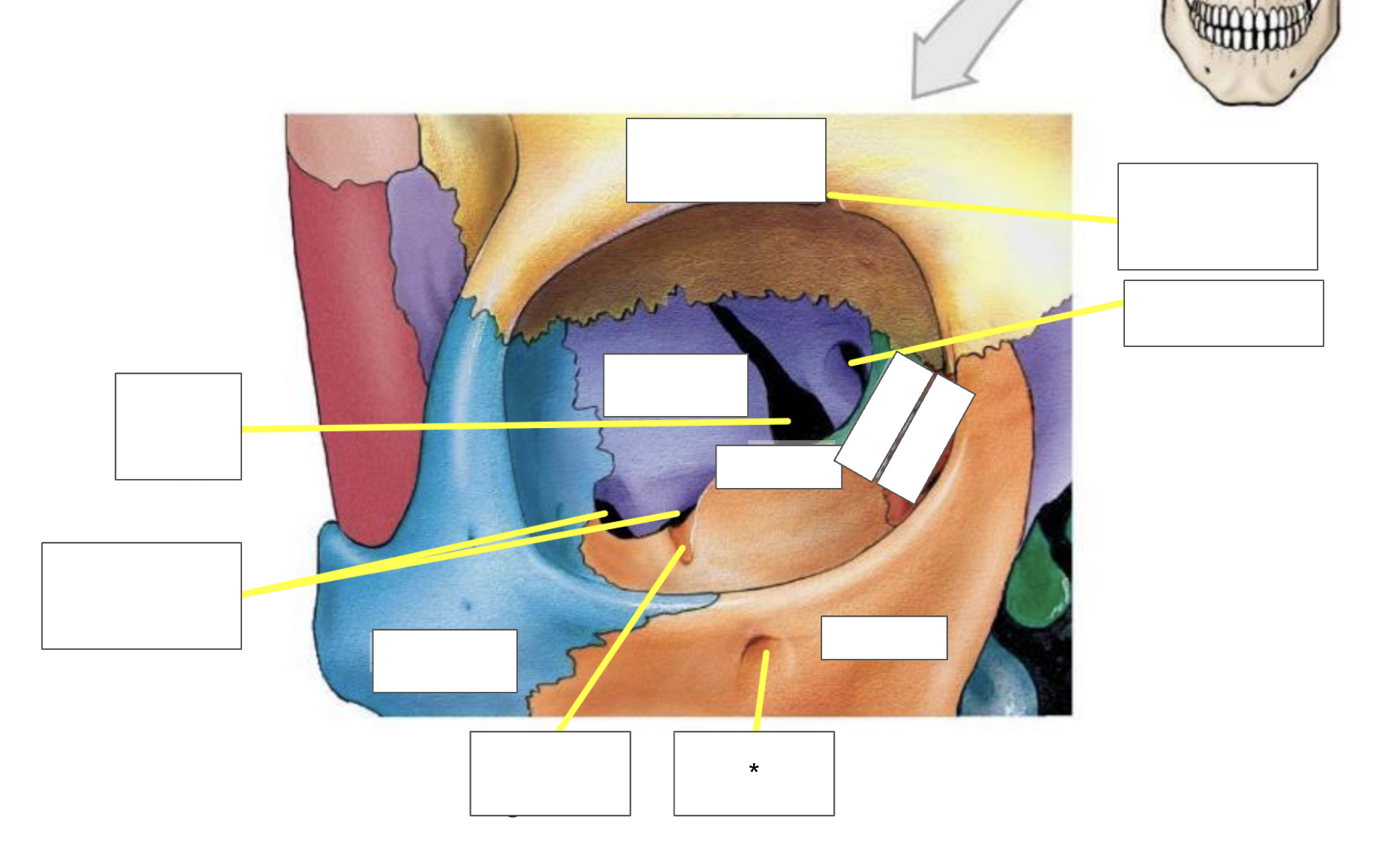 term image