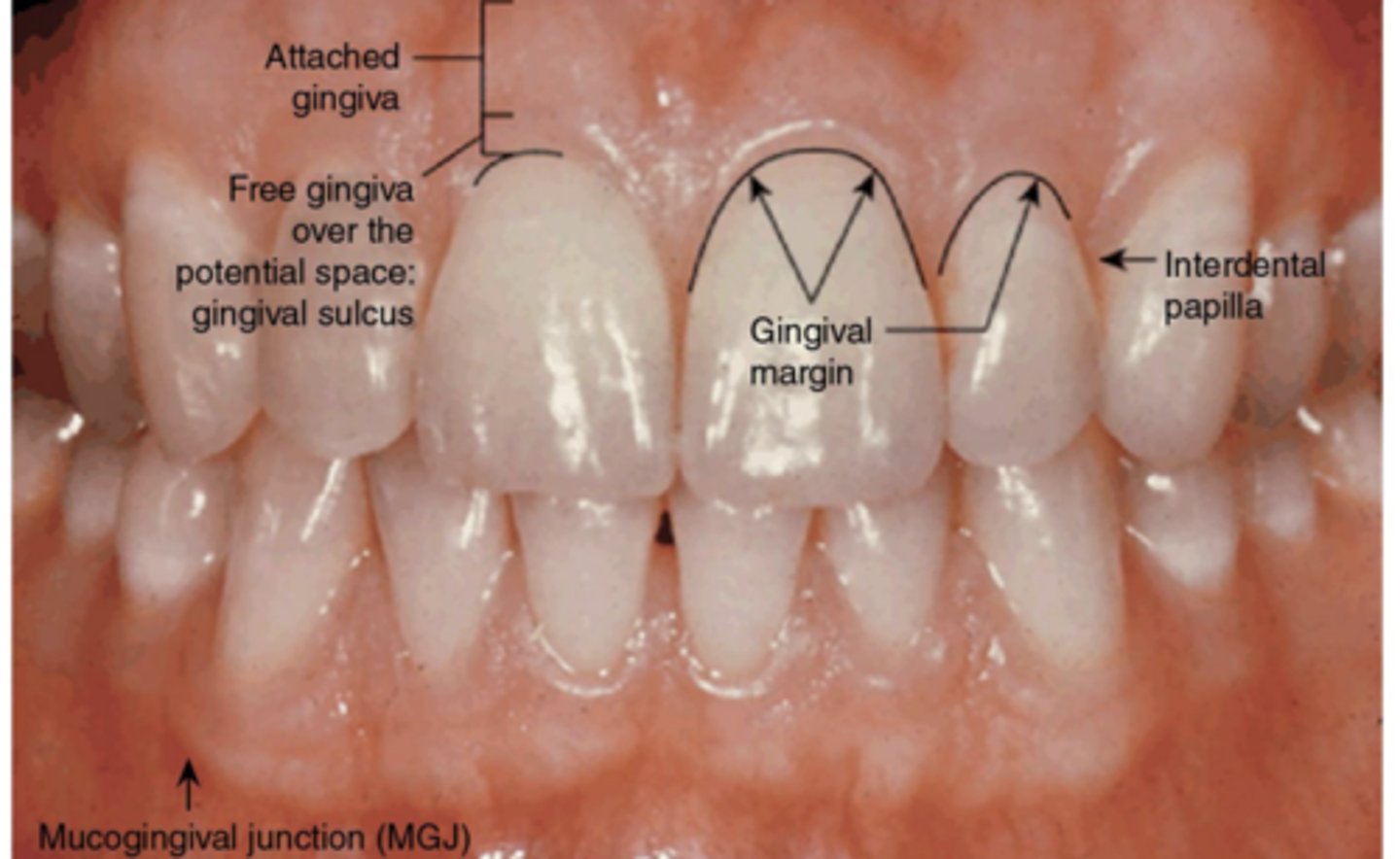 <p>Gingival margin: free gingiva and surround the tooth</p>