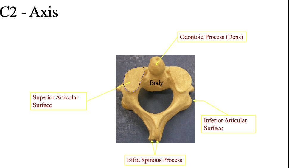 <p>Ontoid process (Dens)</p><ul><li><p>where the pivot point&nbsp;</p></li></ul><p></p><p>Supeiror articular surface</p><ul><li><p>The top flat part (on both sides</p></li></ul><p>Inferior articular surface</p><ul><li><p>bottom flat part posterior&nbsp;</p></li></ul><p>bifid spinous process</p><ul><li><p>The bumpy portion in the back posteiror)</p></li></ul><p></p>