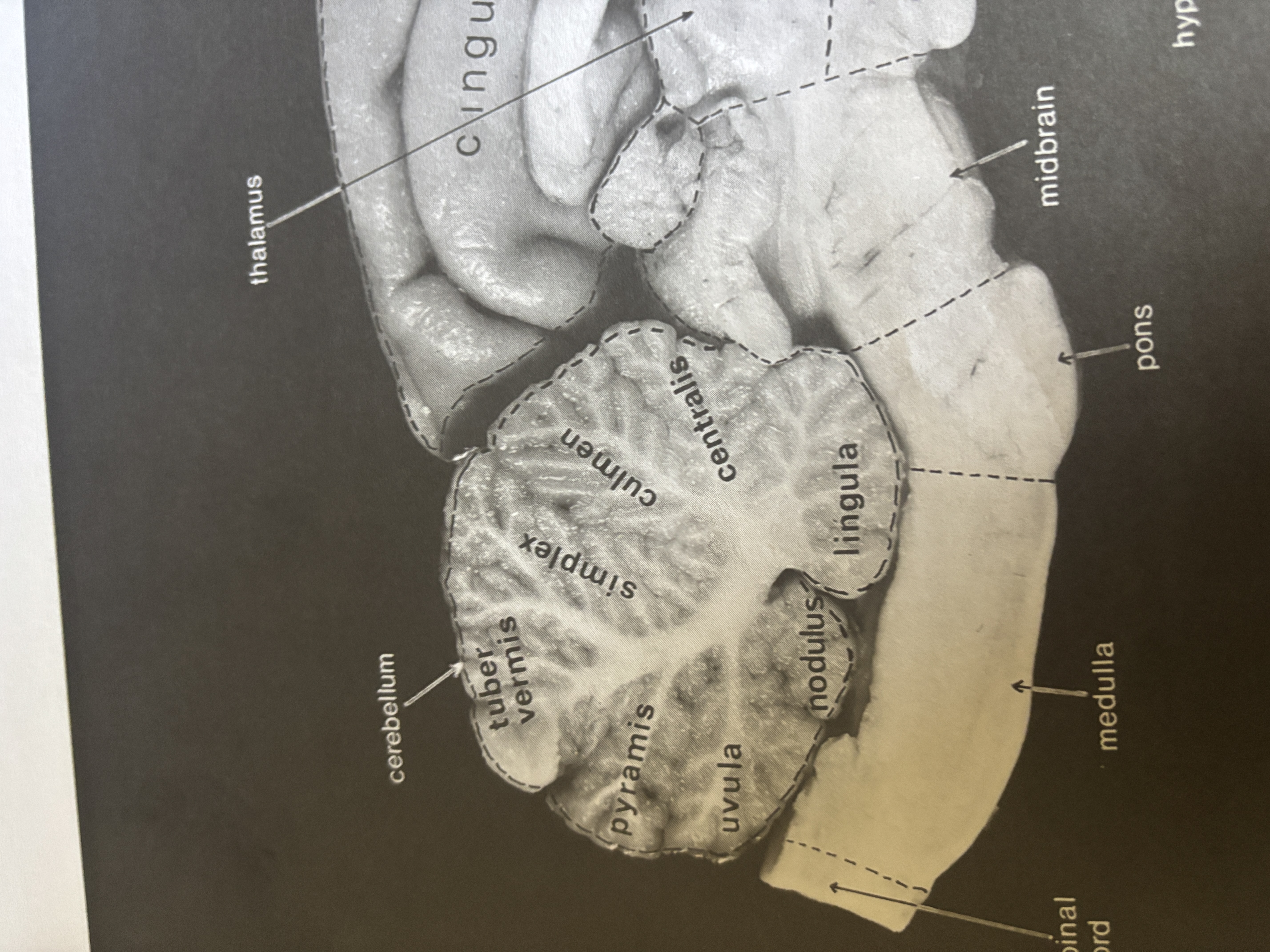 <p>Centralis</p>