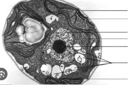 <p>What is the structure near the edge of the cytoplasm with a stringy look?</p>