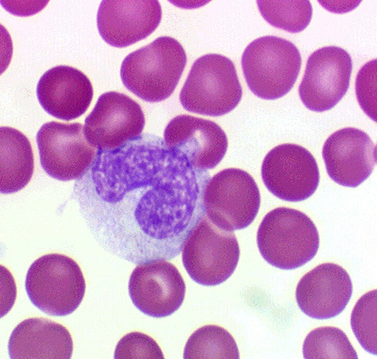 <p>purple - kidney shaped nuclei. Mega sized cell</p>