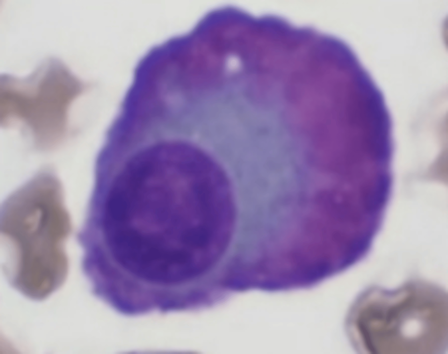 <p>Plasma cell variation</p><p>Retaining the abundant cytoplasm and eccentric nuclear placement of a regular plasma cell, with a reddish tinge to the cytoplasm</p>