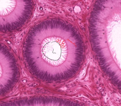 <p>What surface mechanism is this?</p>